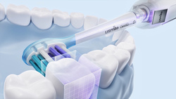 Usmile Y10 White Szczoteczka soniczna + 2 końcówki