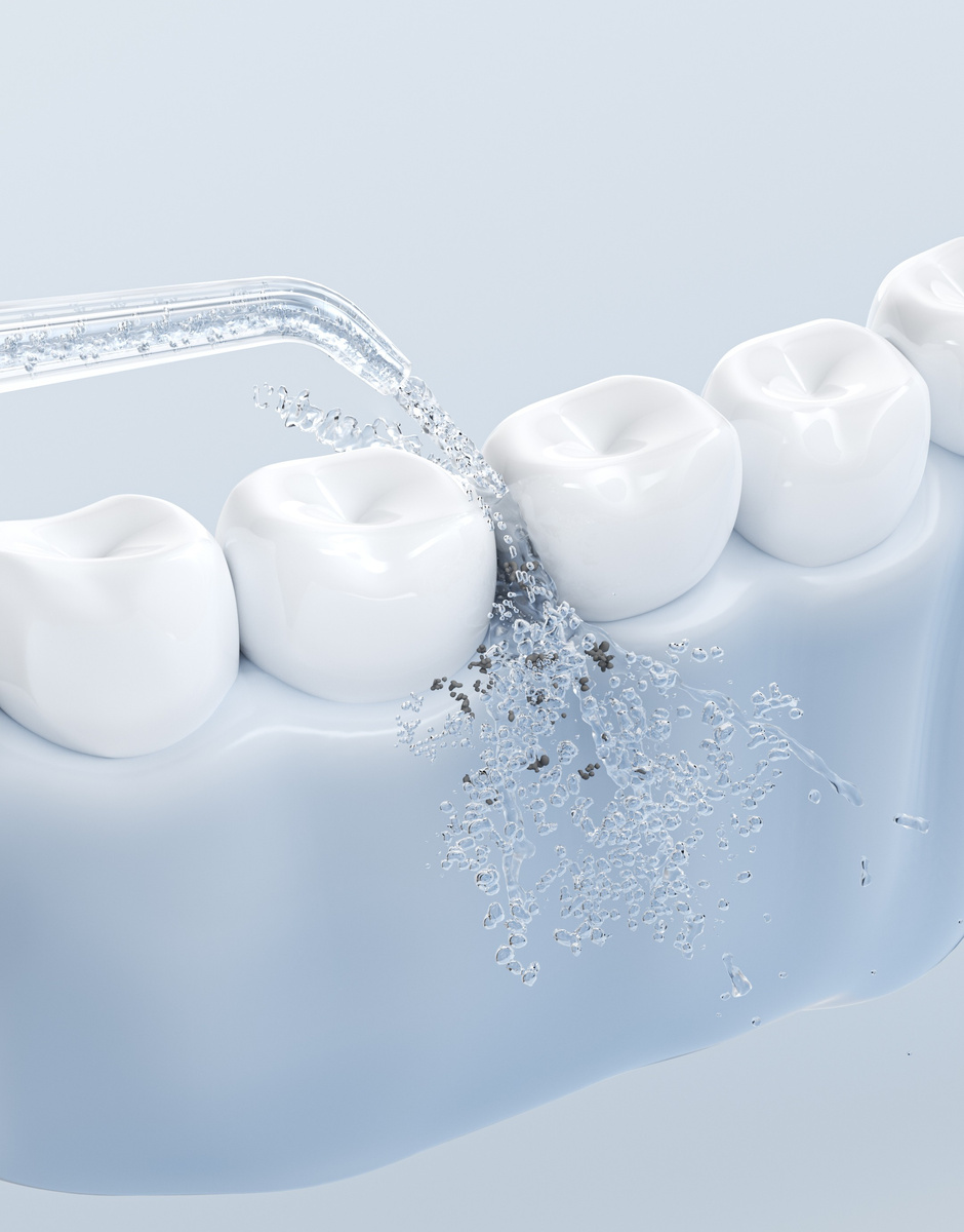 Jimok S5 Green Irygator do zębów pol_pl_Jimok-S5-Green-Irygator-do-zebow-16958_3